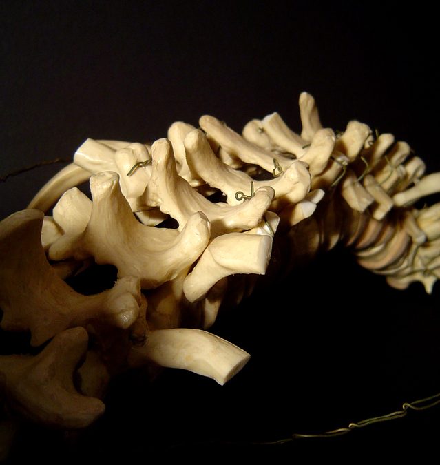 Espondilolistese