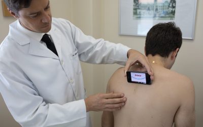 Escoliose: a cirurgia parte 2