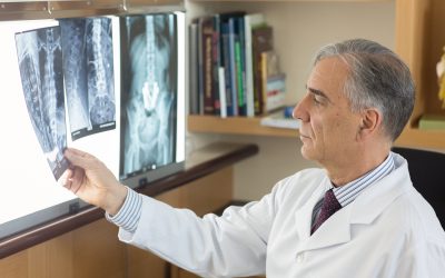 Tratamento para tumores da coluna vertebral